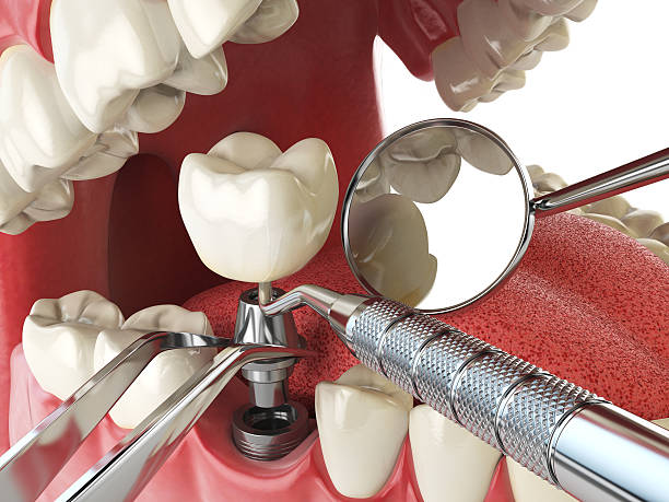 Best Same-Day Emergency Dental Services in Lusby, MD