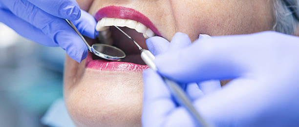 Best Emergency Gum Treatment in Lusby, MD