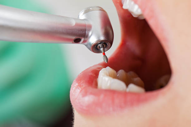 Best Pediatric Emergency Dentist in Lusby, MD